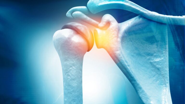 6 Most Common Orthopedic Injuries and How to Treat Them